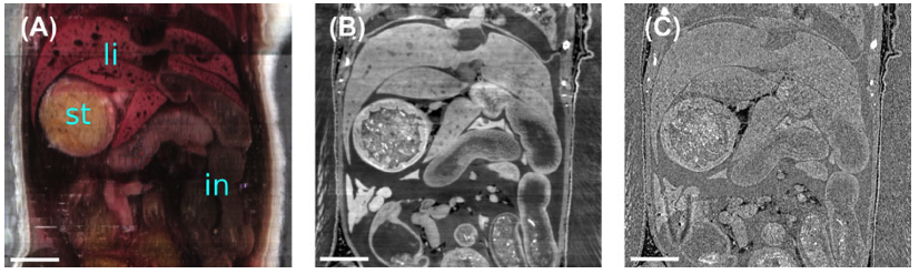 Coronal views of mouse abdomen